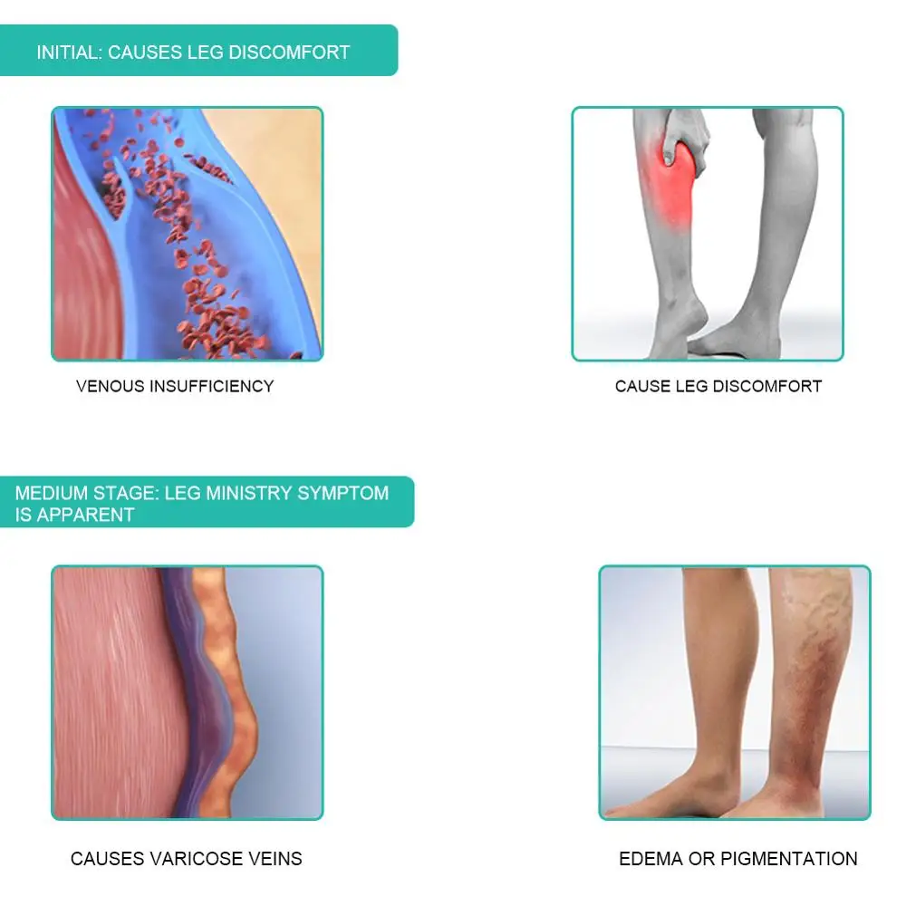 1Pair Medical Compression Sock - Compression Sock Medical ulasan dan harga